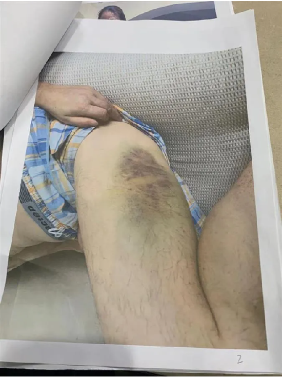 重庆警方致歉！民警违法，破坏的是法制，打碎的是人心